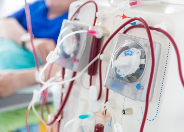 Banyak Anak Menjalani Cuci Darah di RSCM, Ini Penjelasannya